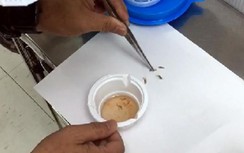Ruồi chui vào tai người đàn ông đẻ trứng, bác sĩ kinh hãi gắp ra đầy giòi