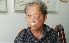 Nhà báo VTV 59 tuổi tố bị côn đồ đánh sưng mặt khi đi ăn sáng
