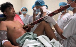 TNGT hi hữu: Thanh niên bị thanh sắt 2m xuyên từ gầm xe đâm thấu ngực