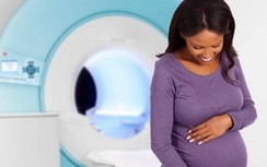 Mẹ bầu đi chụp X-quang có ảnh hưởng gì không, cần lưu ý điều gì?