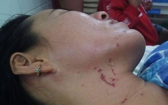 Triệu tập người đàn ông đánh vợ, dìm xuống hồ nước ở Tây Ninh