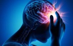 Thói quen có hại nào dễ khiến mắc đột quỵ não, gây tử vong và tàn phế cao?