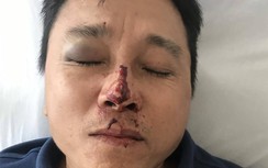 Thừa Thiên Huế: Điều tra một tài xế bị côn đồ đánh nhập viện
