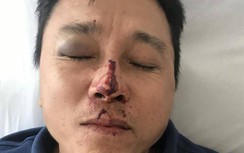 Vụ tài xế bị đánh ở Thừa Thiên Huế: Xe hãng Huệ Thi chạy vượt tuyến 42 km?
