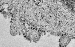 Virus Corona có thể tạo ra hàng ngàn hạt mang virus mới