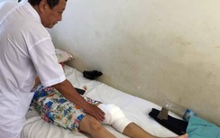 Khánh Hòa: Liên tiếp ca bệnh nguy kịch, biến chứng vì đắp lá lên vết thương