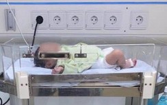 Trẻ 16 ngày tuổi nhiễm virus RSV đến nguy kịch vì nụ hôn của người lớn?