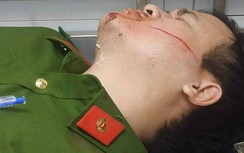 Hai chiến sĩ công an ở Đà Nẵng bị chém khi đang làm nhiệm vụ
