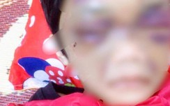 Hải Dương: Khởi tố người mẹ hành hạ dã man con gái 6 tuổi
