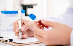 Có cần thiết xét nghiệm kháng thể sau tiêm vaccine Covid-19?