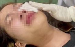 Hải Phòng: Điều tra nhóm đối tượng hành hung nữ sinh nhập viện