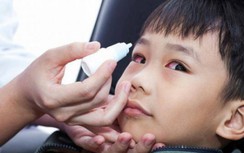 Trẻ đau mắt đỏ hậu Covid-19, cẩn trọng suy giảm thị lực vì lý do này