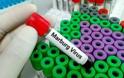 WHO cảnh báo bùng phát dịch virus mới có khả năng lây nhiễm cao
