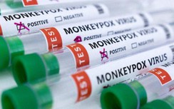 Thêm một nước Đông Nam Á ghi nhận ca nhiễm virus đậu mùa khỉ đầu tiên