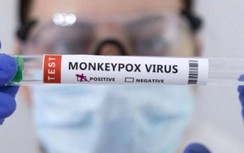 Mỹ tuyên bố tình trạng khẩn cấp đối với bệnh đậu mùa khỉ