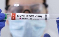 Ca bệnh đậu mùa khỉ đầu tiên ở Việt Nam lây bệnh khi nào, từ đâu?