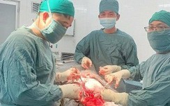 Nghẹt thở ca phẫu thuật cứu nam sinh 15 tuổi chấn thương não do TNGT