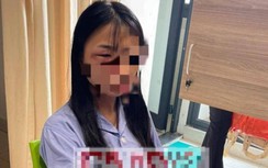 Nữ sinh lớp 8 ở Hà Nội bị đánh hội đồng, phải nhập viện