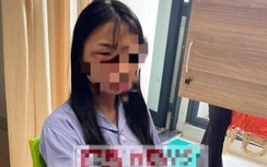 Vụ nữ sinh lớp 8 bị đánh hội đồng ở Hà Nội: Giám định thương tật nạn nhân