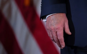 Nhà Trắng nêu lý do ông Trump bị sưng chân, tím mu bàn tay