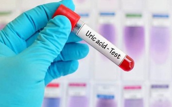 Liệu chỉ số acid uric máu cao là mắc bệnh gout?