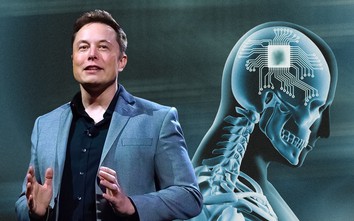 Tác dụng thần kỳ từ chip não của tỷ phú Elon Musk