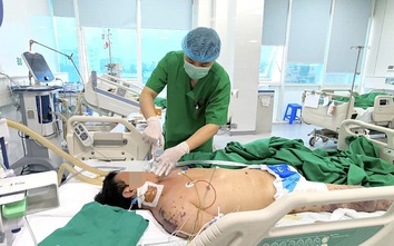 Người đàn ông nguy kịch vì vi khuẩn não mô cầu sau đám cỗ