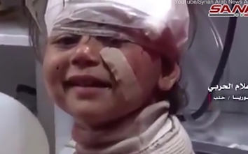 Em bé Syria mặt băng bó vẫn cười tươi lay động bao con tim