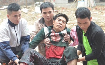 Nghịch đầu đạn sau nổ lớn ở Bắc Ninh, nam thanh niên nát tay