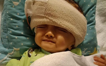 Cộng đồng mạng hỗ trợ, bé Hoài Thương đã được phẫu thuật