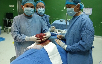 Cắt bỏ khối u "khủng" khỏi cổ cụ bà U70