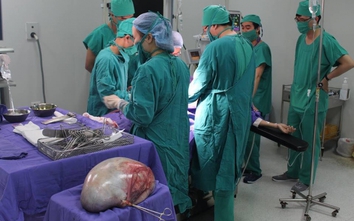 Một phụ nữ Quảng Ninh mang khối u nang buồng trứng nặng 6 kg