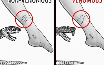 12 mẹo sinh tồn hữu ích giúp cứu sống bạn khi nguy cấp