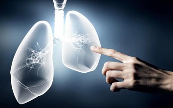 Ăn 4 thứ này thường xuyên có thể “hút sạch” chất độc trong phổi