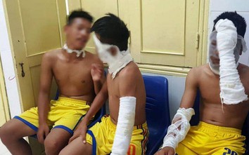Nổ chùm bóng bay, 3 cầu thủ Sông Lam Nghệ An bị bỏng