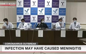 Nhật Bản nghi ngờ virus Covid-19 có thể gây viêm màng não