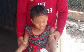Vì sao chưa giám định thương tích bé 6 tuổi ở Sóc Trăng bị cha bạo hành?