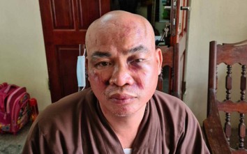 Hải Phòng: Sư chùa bị đánh trọng thương và mất tài sản