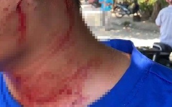 Vụ phụ xe buýt Huế - Đà Nẵng bị đánh: Chuyển hồ sơ đề nghị VKS truy tố