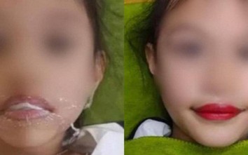 Livestream xăm môi cho con gái 5 tuổi để quảng cáo TMV: Bác sĩ cảnh báo gì?