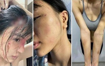 Công an vào cuộc vụ siêu mẫu Khả Trang tố bị chồng chưa cưới bạo hành