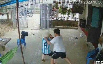 Video: Bé trai bạch tạng bị người đàn ông hành hung tại Quốc Oai, Hà Nội