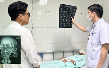Giải thoát khối u khổng lồ trên khuôn mặt nữ bệnh nhân ở Thái Bình
